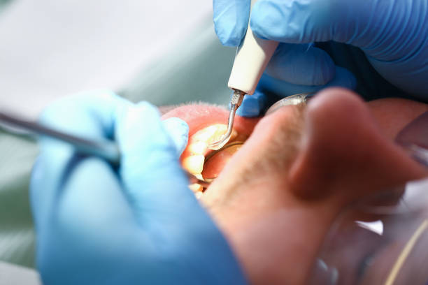Best Pediatric Emergency Dentist in Country Clu, CA