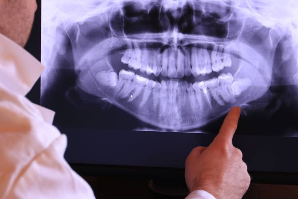 Best Emergency Broken Tooth Repair in Country Clu, CA