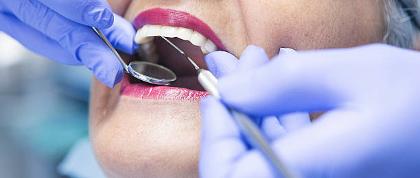 Best Emergency Treatment for Toothache in Country Clu, CA